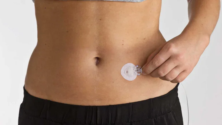 Neria Subkutannadel in der Anwendung