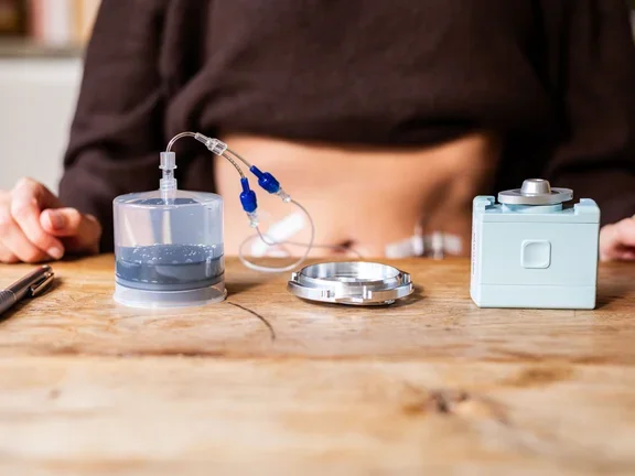 Subkutane Immunglobulintherapie SO-CONNECT+ 100