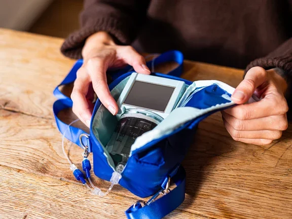 Subkutane Immunglobulintherapie SO-CONNECT+ 100